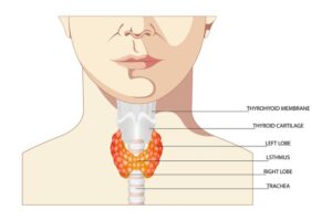 Cervical stenosis