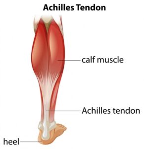 Achilles tendinopathy