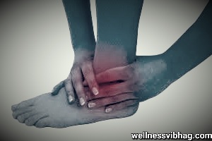 Ankle arthritis