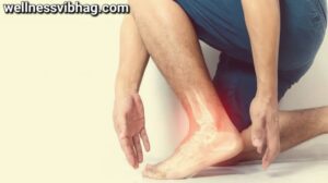 Ankle arthritis