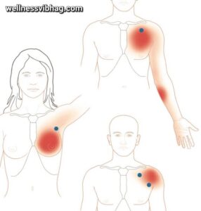 Pectoralis Muscle