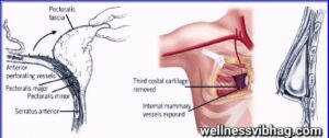 Pectoralis Muscle